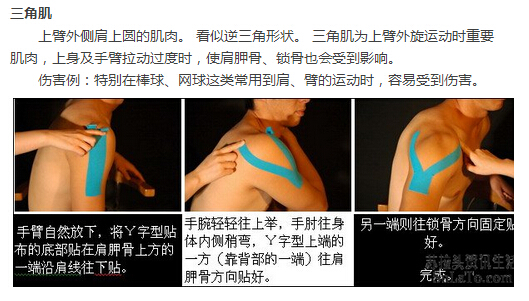 貼布貼敷于手臂三角肌效果圖